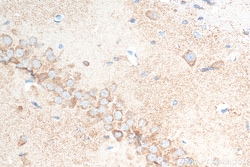Ataxin 2 Mouse Monoclonal Antibody, Proteintech Unconjugated; 150 &mu;L:Antibodies,