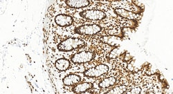 B23/NPM1 Rabbit Recombinant Antibody, Proteintech Unconjugated; 20 &mu;L:Antibodies,