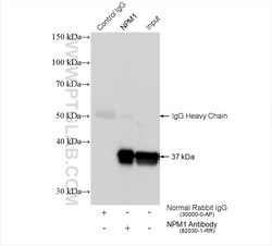 B23/NPM1 Rabbit Recombinant Antibody, Proteintech Unconjugated; 20 &mu;L:Antibodies,