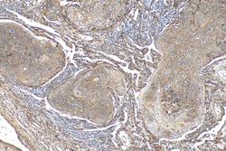 B7-H3/CD276 Rabbit Polyclonal Antibody, Proteintech Unconjugated; 20 &mu;L:Antibodies,