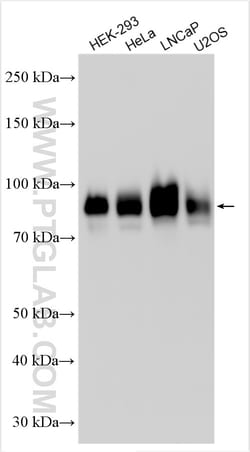 B7-H3/CD276 Rabbit Polyclonal Antibody, Proteintech Unconjugated; 20 &mu;L:Antibodies,
