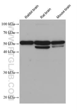 IRSp53 Mouse Monoclonal Antibody, Proteintech:Antibodies:Primary Antibodies