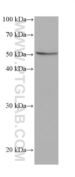IRSp53 Mouse Monoclonal Antibody, Proteintech:Antibodies:Primary Antibodies