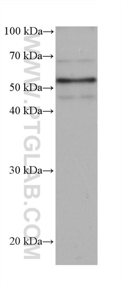 IRSp53 Mouse Monoclonal Antibody, Proteintech:Antibodies:Primary Antibodies