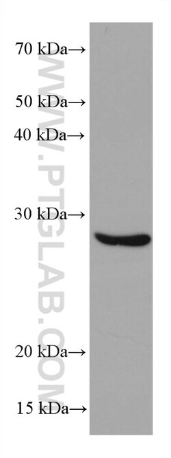 BCAS2 Mouse Monoclonal Antibody, Proteintech Unconjugated; 150 &mu;L:Antibodies,