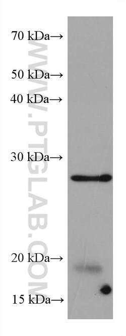 BCAS2 Mouse Monoclonal Antibody, Proteintech Unconjugated; 150 &mu;L:Antibodies,