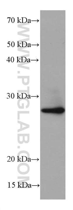 BCAS2 Mouse Monoclonal Antibody, Proteintech Unconjugated; 150 &mu;L:Antibodies,
