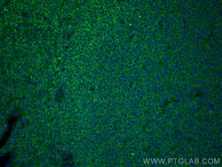 BCL2 Rabbit Recombinant Antibody, Proteintech:Antibodies:Primary Antibodies