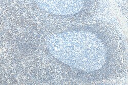 BCL2 Rabbit Recombinant Antibody, Proteintech:Antibodies:Primary Antibodies