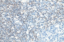 BCL2 Rabbit Recombinant Antibody, Proteintech:Antibodies:Primary Antibodies
