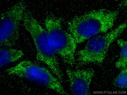 BDH2 Mouse Monoclonal Antibody, Proteintech:Antibodies:Primary Antibodies