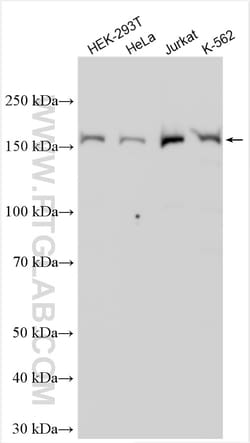 BLM Rabbit Polyclonal Antibody, Proteintech Unconjugated; 150 &mu;L:Anticorps,