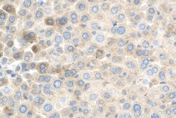 BLZF1 Rabbit Polyclonal Antibody, Proteintech Unconjugated; 20 &mu;L:Antibodies,