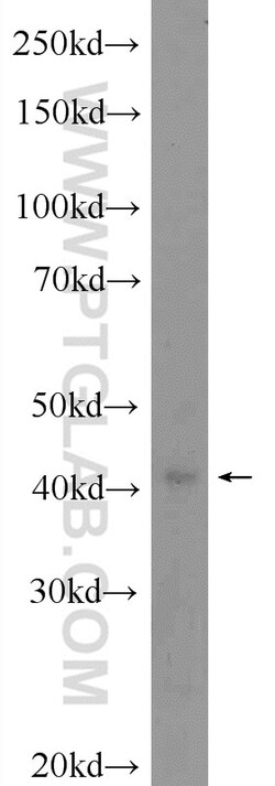 BLZF1 Rabbit Polyclonal Antibody, Proteintech Unconjugated; 20 &mu;L:Antibodies,