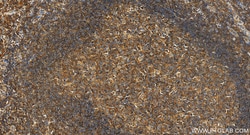 BMP6 Rabbit Polyclonal Antibody, Proteintech:Antibodies:Primary Antibodies