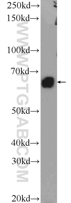 BMP6 Rabbit Polyclonal Antibody, Proteintech:Antibodies:Primary Antibodies