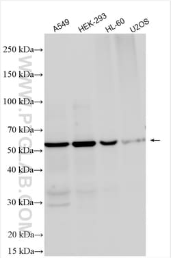 BMP6 Rabbit Polyclonal Antibody, Proteintech:Antibodies:Primary Antibodies