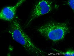 BRAWNIN Rabbit Polyclonal Antibody, Proteintech Unconjugated; 20 &mu;L:Antibodies,