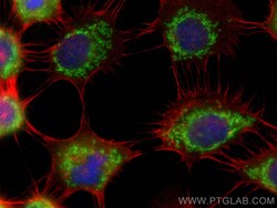 BRAWNIN Rabbit Polyclonal Antibody, Proteintech Unconjugated; 20 &mu;L:Antibodies,
