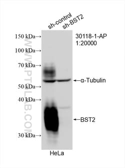 BST2 Rabbit Polyclonal Antibody, Proteintech Unconjugated; 20 &mu;L:Antibodies,