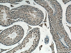 Beta TRCP Rabbit Polyclonal Antibody, Proteintech:Antibodies:Primary Antibodies
