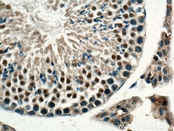 Beta TRCP Rabbit Polyclonal Antibody, Proteintech:Antibodies:Primary Antibodies