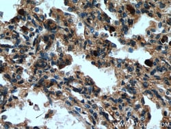 MCEMP1 Rabbit Polyclonal Antibody, Proteintech Unconjugated; 150 &mu;L:Antibodies,