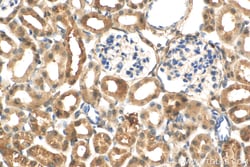 C1orf54 Rabbit Polyclonal Antibody, Proteintech Unconjugated; 20 &mu;L:Antibodies,