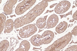 RALGAPA2 Rabbit Polyclonal Antibody, Proteintech:Antibodies:Primary Antibodies