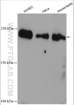 RALGAPA2 Rabbit Polyclonal Antibody, Proteintech:Antibodies:Primary Antibodies