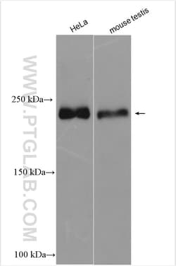 RALGAPA2 Rabbit Polyclonal Antibody, Proteintech:Antibodies:Primary Antibodies