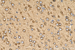 ERLEC1 Rabbit Polyclonal Antibody, Proteintech 20 &mu;L | Buy Online | Proteintech | Fisher Scientific