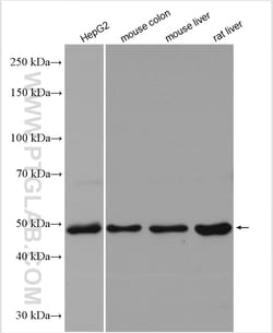 ERLEC1 Rabbit Polyclonal Antibody, Proteintech 20 &mu;L | Buy Online | Proteintech | Fisher Scientific