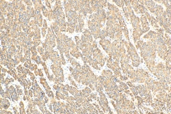 C4 Gamma Chain Rabbit Polyclonal Antibody, Proteintech 150 &mu;L | Buy Online | Proteintech | Fisher Scientific