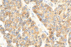 C4 Gamma Chain Rabbit Polyclonal Antibody, Proteintech 150 &mu;L | Buy Online | Proteintech | Fisher Scientific