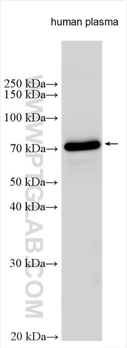 C8A Rabbit Polyclonal Antibody, Proteintech:Antibodies:Primary Antibodies