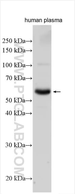 C9 Rabbit Polyclonal Antibody, Proteintech