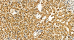 C9orf64 Rabbit Polyclonal Antibody, Proteintech Unconjugated; 150 &mu;L:Antikörper