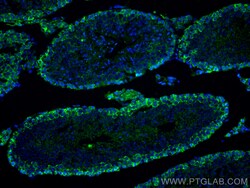 CoraLite Plus 488-conjugated C9orf72 Rabbit Polyclonal Antibody, Proteintech:Antibodies:Primary