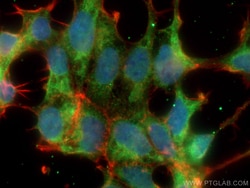 CACYBP Mouse Monoclonal Antibody, Proteintech Unconjugated; 20 &mu;L:Antibodies,