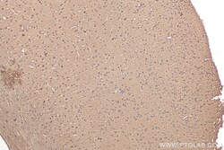 CACYBP Mouse Monoclonal Antibody, Proteintech Unconjugated; 20 &mu;L:Antibodies,