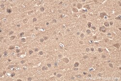 CACYBP Mouse Monoclonal Antibody, Proteintech Unconjugated; 20 &mu;L:Antibodies,