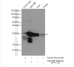 CACYBP Mouse Monoclonal Antibody, Proteintech Unconjugated; 20 &mu;L:Antibodies,