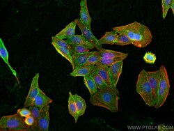 CAP1 Mouse Monoclonal Antibody, Proteintech:Antibodies:Primary Antibodies