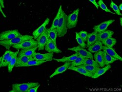 CAP1 Mouse Monoclonal Antibody, Proteintech:Antibodies:Primary Antibodies