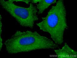 CAP1 Mouse Monoclonal Antibody, Proteintech:Antibodies:Primary Antibodies