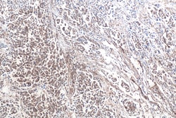 CAP1 Mouse Monoclonal Antibody, Proteintech:Antibodies:Primary Antibodies