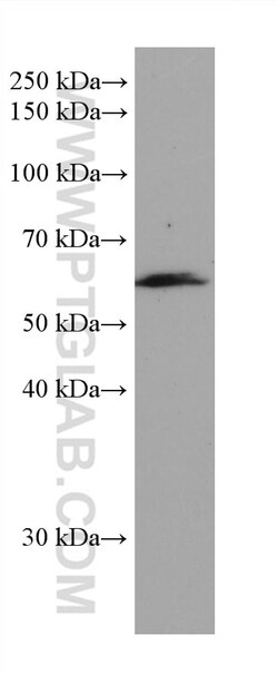 CAP1 Mouse Monoclonal Antibody, Proteintech:Antibodies:Primary Antibodies
