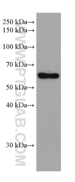 CAP1 Mouse Monoclonal Antibody, Proteintech:Antibodies:Primary Antibodies
