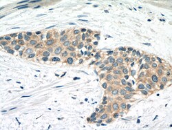 CAPN1 Mouse Monoclonal Antibody, Proteintech:Antistoffer:Primære antistoffer